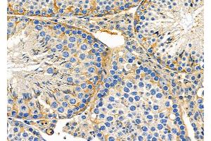 ABIN6261039 and ABIN6278845 at 1/100 staining Mouse testis tissue by IHC-P.