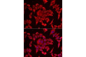 Immunofluorescence analysis of HeLa cells using SLC20A2 antibody. (SLC20A2 Antikörper  (AA 235-485))