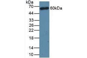 Detection of CD4 in Mouse Thymus Tissue using Polyclonal Antibody to Cluster Of Differentiation 4 (CD4) (CD4 Antikörper  (AA 27-394))