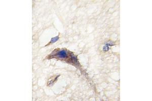 Formalin-fixed and paraffin-embedded human brain tissue reacted with DM1 Antibody (N-term) (ABIN389179 and ABIN2839342) , which was peroxidase-conjugated to the secondary antibody, followed by DAB staining. (DAAM1 Antikörper  (N-Term))