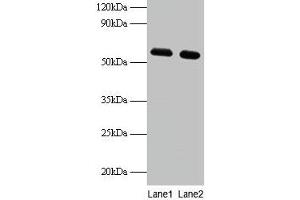 Western blot All lanes: PHGDH antibody at 2 μg/mL Lane 1: EC109 whole cell lysate Lane 2: 293T whole cell lysate Secondary Goat polyclonal to rabbit IgG at 1/15000 dilution Predicted band size: 57 kDa Observed band size: 57 kDa (PHGDH Antikörper  (AA 2-251))