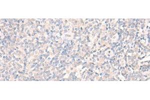 Immunohistochemistry (Paraffin-embedded Sections) (IHC (p)) image for anti-Leukocyte Immunoglobulin-Like Receptor, Subfamily A (With TM Domain), Member 2 (LILRA2) antibody (ABIN7246358)