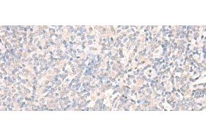 Immunohistochemistry of paraffin-embedded Human tonsil tissue using LILRA2 Polyclonal Antibody at dilution of 1:40(x200) (LILRA2 Antikörper)