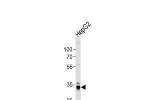 Western blot analysis of lysate from HepG2 cell line, using ST Antibody (N-term) (ABIN392000 and ABIN2841785).