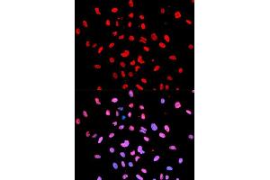 Immunofluorescence analysis of U2OS cells using Phospho-Btk-Y223 antibody (ABIN5969941). (BTK Antikörper  (pTyr223))