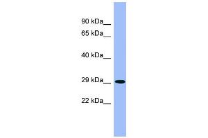 WB Suggested Anti-PHYH Antibody Titration: 0. (PHYH Antikörper  (Middle Region))