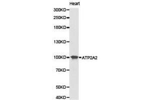 Western Blotting (WB) image for anti-ATPase, Ca++ Transporting, Cardiac Muscle, Slow Twitch 2 (ATP2A2) antibody (ABIN1871156) (ATP2A2 Antikörper)
