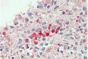 ABIN1782177 (5µg/ml) staining of paraffin embedded Human Spleen. (BLVRB Antikörper  (AA 38-49))