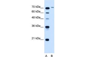 Western Blotting (WB) image for anti-Solute Carrier Organic Anion Transporter Family, Member 6A1 (SLCO6A1) antibody (ABIN2462780)