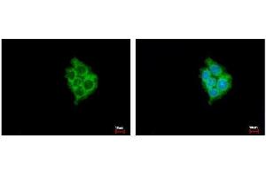 ICC/IF Image MIA3 antibody [N1], N-term detects MIA3 protein at Cytoplasm by immunofluorescent analysis.