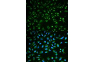 Immunofluorescence analysis of MCF7 cell using NT5E antibody. (CD73 Antikörper  (AA 290-550))