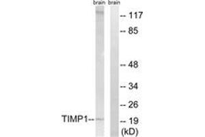 Western blot analysis of extracts from rat brain cells, using TIMP1 Antibody.