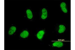 Immunofluorescence of monoclonal antibody to SMARCD2 on HeLa cell. (SMARCD2 Antikörper  (AA 398-474))
