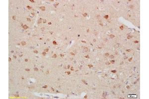 Formalin-fixed and paraffin embedded rat brain labeled with Anti-Gastrin receptor Polyclonal Antibody, Unconjugated (ABIN734318) at 1:200 followed by conjugation to the secondary antibody and DAB staining (CCKBR Antikörper  (AA 301-400))