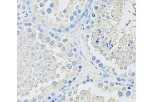 Immunohistochemistry of paraffin-embedded Mouse testis using SLC2A9 Polyclonal Antibody at dilution of 1:100 (40x lens). (SLC2A9 Antikörper)