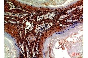 Immunohistochemical analysis of paraffin-embedded human-skin, antibody was diluted at 1:200 (ADAMTS18 Antikörper  (AA 1030-1110))