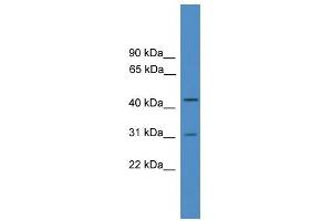 WB Suggested Anti-OTUD6A Antibody Titration: 0. (OTUD6A Antikörper  (Middle Region))
