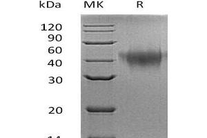 Western Blotting (WB) image for Tumor Necrosis Factor Receptor Superfamily, Member 1B (TNFRSF1B) protein (His tag) (ABIN7320738) (TNFRSF1B Protein (His tag))