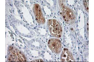 Immunohistochemical staining of paraffin-embedded Human Kidney tissue using anti-SOCS3 mouse monoclonal antibody. (SOCS3 Antikörper)