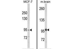 (LEFT) Western blot analysis of VPS53 Antibody (N-term) in MCF-7 cell line lysates (35ug/lane). (VPS53 Antikörper  (N-Term))