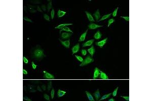 Immunofluorescence analysis of U2OS cells using NUTF2 Polyclonal Antibody (NUTF2 Antikörper)