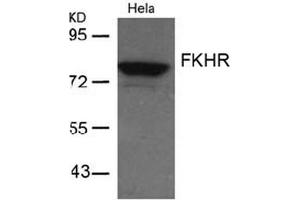 Image no. 2 for anti-Forkhead Box O1 (FOXO1) (AA 254-258) antibody (ABIN197334) (FOXO1 Antikörper  (AA 254-258))