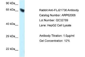 Western Blotting (WB) image for anti-Carboxylesterase 3 (CES3) (C-Term) antibody (ABIN786537) (CES3 Antikörper  (C-Term))