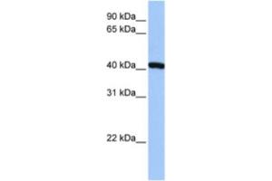 Western Blotting (WB) image for anti-FtsJ RNA Methyltransferase Homolog 1 (FTSJ1) antibody (ABIN2463265) (FTSJ1 Antikörper)