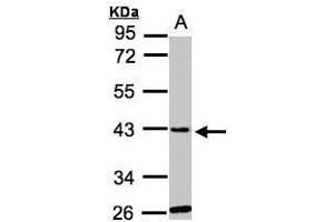 WB Image Sample(30 ug whole cell lysate) A:Hep G2 , 10% SDS PAGE antibody diluted at 1:1000 (GLYATL1 Antikörper)