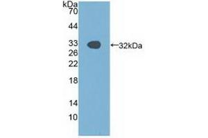 Western blot analysis of recombinant Human PAK1. (PAK1 Antikörper  (AA 252-501))