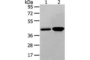 Western Blotting (WB) image for anti-Vasohibin 2 (VASH2) antibody (ABIN5958782) (Vasohibin 2 Antikörper)
