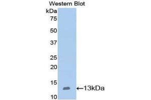 Western blot analysis of the recombinant protein. (Nephrin Antikörper  (AA 39-144))