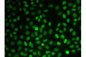 Immunofluorescence analysis of U2OS cells using Nono antibody. (NONO Antikörper  (AA 1-300))