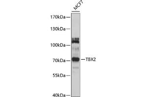Western blot analysis of extracts of MCF-7 cells, using TBX2 antibody (ABIN6130916, ABIN6148906, ABIN6148907 and ABIN6214429) at 1:1000 dilution. (TBX2 Antikörper  (AA 300-470))