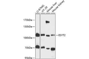 Western blot analysis of extracts of various cell lines, using ESYT2 antibody (ABIN6133009, ABIN6140463, ABIN6140464 and ABIN6216602) at 1:3000 dilution. (FAM62B Antikörper  (AA 630-760))