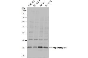 WB Image Aspartoacylase antibody detects Aspartoacylase protein by western blot analysis. (ASPA Antikörper)
