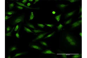 Immunofluorescence of monoclonal antibody to PRKCD on HeLa cell. (PKC delta Antikörper  (AA 577-676))