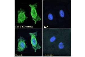 ABIN184604 Immunofluorescence analysis of paraformaldehyde fixed HeLa cells, permeabilized with 0.