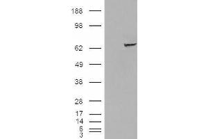 HEK293 overexpressing IGF2BP2 (ABIN5436057) and probed with ABIN238651 (mock transfection in first lane).