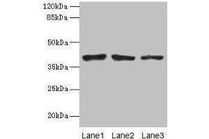 Western blot All lanes: ATP6AP2 antibody at 10 μg/mL Lane 1: Mouse eye tissue Lane 2: COLO205 whole cell lysate Lane 3: Hela whole cell lysate Secondary Goat polyclonal to rabbit IgG at 1/10000 dilution Predicted band size: 40, 36 kDa Observed band size: 40 kDa (ATP6AP2 Antikörper  (AA 17-350))