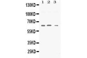 Western blot analysis of Synapsin II expression in rat brain extract ( Lane 1), mouse brain extract ( Lane 2) and U87 whole cell lysates ( Lane 3).