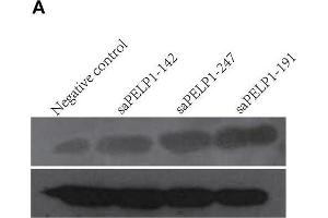 PELP1 activation promoted proliferation, colony formation, migration of GES-1 in vitro. (PELP1 Antikörper)