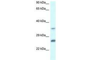 Image no. 1 for anti-Carbonyl Reductase 4 (CBR4) (AA 156-205) antibody (ABIN6747447) (CBR4 Antikörper  (AA 156-205))