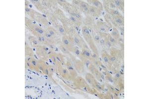 Immunohistochemistry of paraffin-embedded human liver using PTTG1 antibody (ABIN5974823) at dilution of 1/100 (40x lens). (PTTG1 Antikörper)