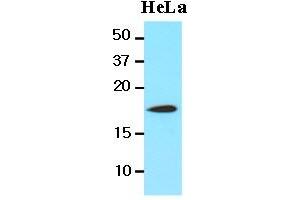 Western Blotting (WB) image for anti-Cofilin 1 (CFL1) (AA 1-166), (N-Term) antibody (ABIN336102) (Cofilin Antikörper  (N-Term))