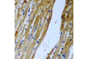 Immunohistochemical analysis of Malcavernin staining in rat heart formalin fixed paraffin embedded tissue section. (CCM2 Antikörper)