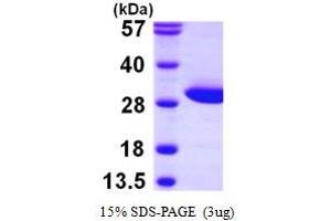 SDS-PAGE (SDS) image for Fumarylacetoacetate Hydrolase Domain Containing 1 (FAHD1) (AA 1-224) protein (His tag) (ABIN667344)