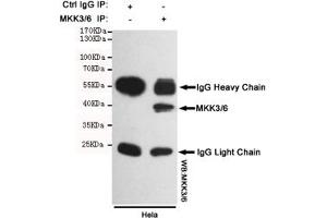 Immunoprecipitation analysis of Hela cell lysates using MKK3/6 mouse mAb. (MKK3/6 Antikörper)