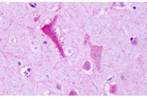 Anti-GPR137B antibody IHC staining of brain, neurons. (GPR137B Antikörper  (C-Term))