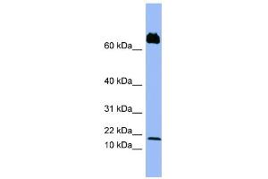 WB Suggested Anti-PF4V1 Antibody Titration:  0.